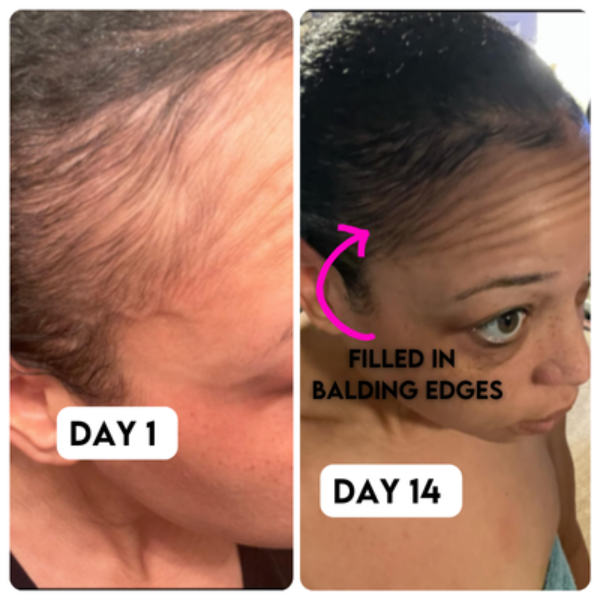 VIRAL "EXTREME STRENGTH" Hair Growth Serum -