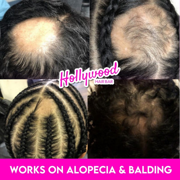VIRAL "EXTREME STRENGTH" Hair Growth Serum -