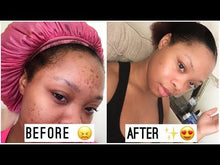 DARK SPOT REMOVER
