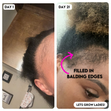 3 Step Grow My Edges Kit (Extra Strength)