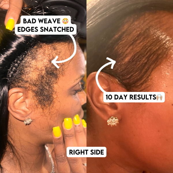 Sheila J. — before and after