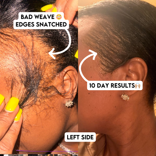 VIRAL "EXTREME STRENGTH" Hair Growth Serum 2pk