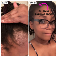 2 Step Grow My Edges Kit (Regular Strength)