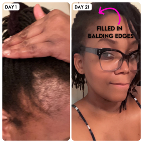 Sandra D. — before and after