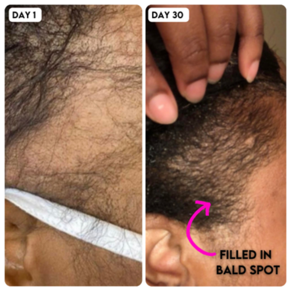 VIRAL "EXTREME STRENGTH" Hair Growth Serum 2pk