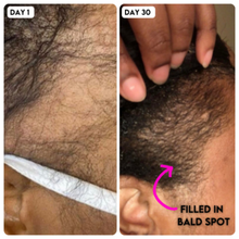 VIRAL "EXTREME STRENGTH" Hair Growth Serum -