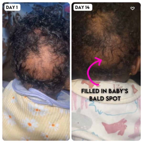 Casherril H. — before and after