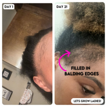 EXTREME Super Grow My Edges Kit