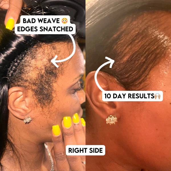 Tiffany Rose - CEO — before and after